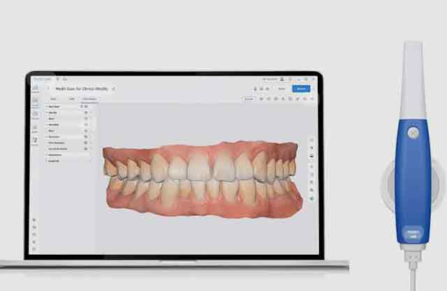 口腔内スキャナー